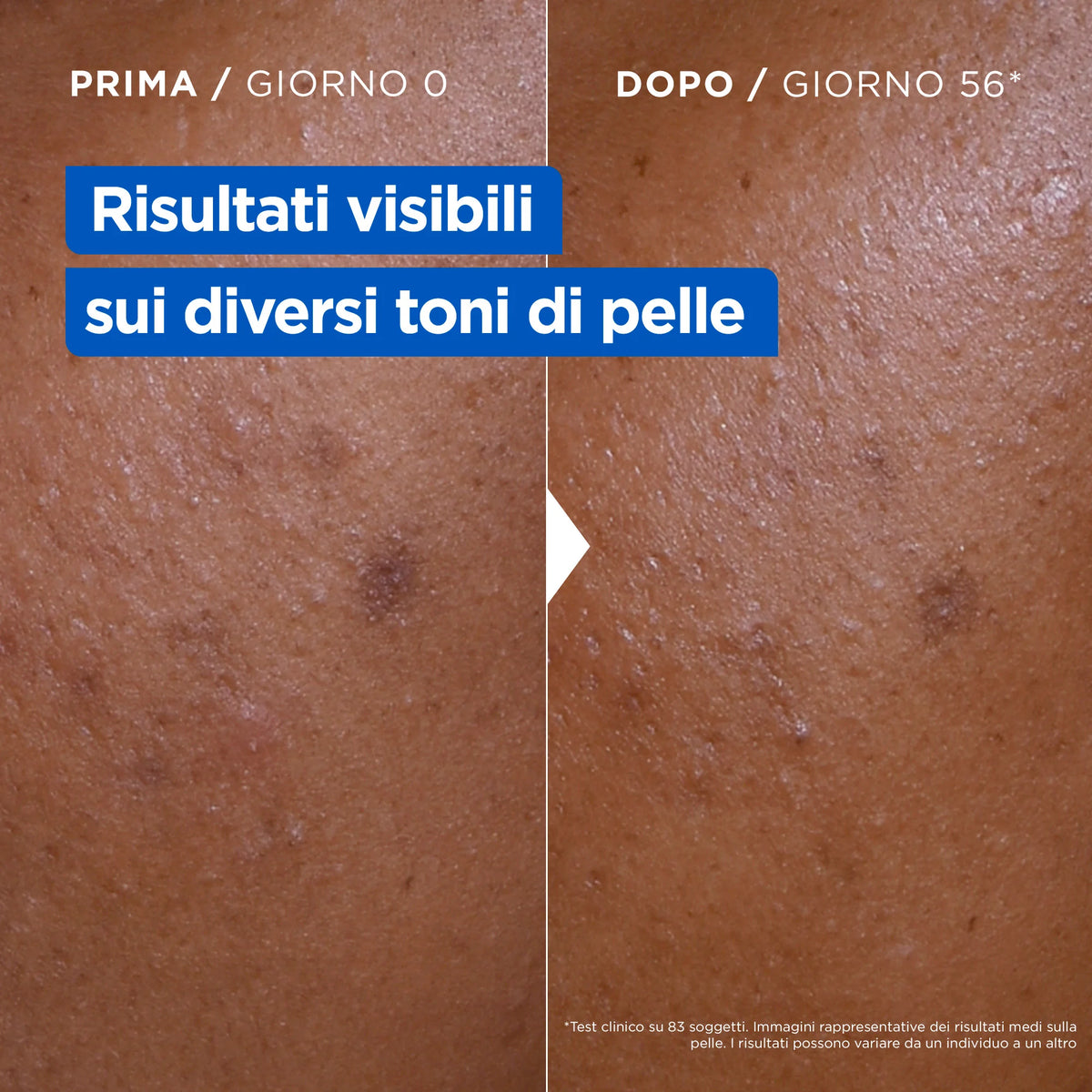 ✨ Mixa Niacinamide Bright – Lozione Illuminante per il Corpo – 250 ml